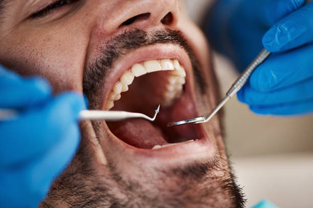 Best Emergency Dentist for Special Needs Patients in Pflugerville, TX