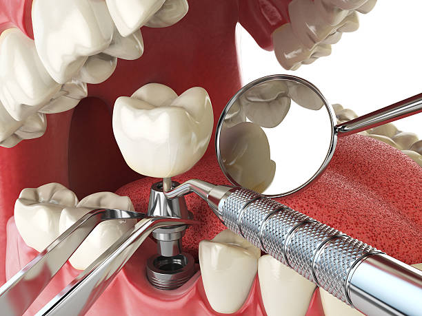 Best Emergency Dentist for Knocked-Out Tooth in Pflugerville, TX